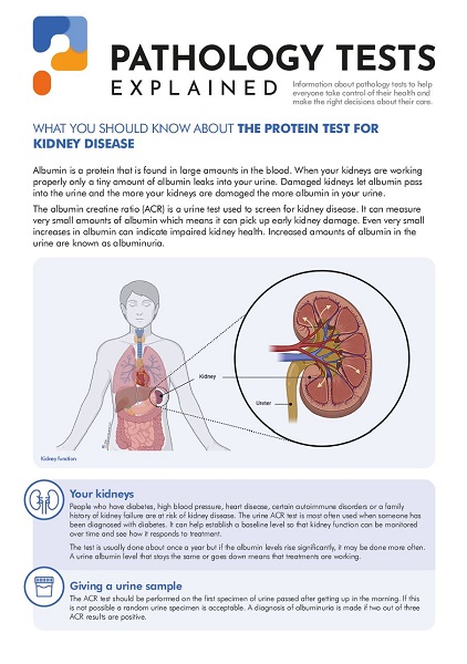 Protein test for kidney disease