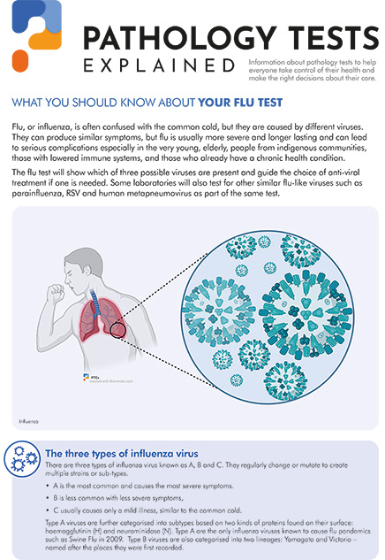 Influenza